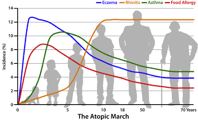 Image result for Allergic Triad