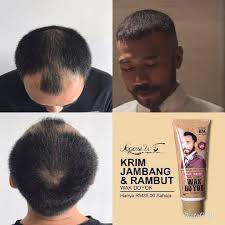 Produk wak doyok bikin ganteng maksimal (perawatan rambut, styling rambut) di lazada ramadan sale | gratis ongkir bisa cod voucher diskon. Wd Jambang Ventures Nak Janggut Jambang Misai Lebat Seperti Wak Doyok Facebook