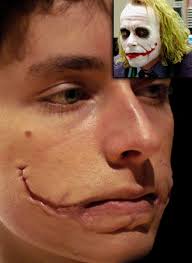 Machine savn scanner scar symmetry scardust scarlet leaves scarleth schwarzer engel scordatura sebastian bach secrecy secret sphere seether semargl semblant sentenced sentimen beltza sentinel september. How To Do Joker Makeup Scars Saubhaya Makeup