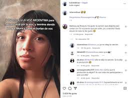 Se enfrentaron en La Voz Argentina con la participante víctima de burlas y  revelaron un injusto requisito