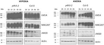 Roxy's collection of swimsuits for women has designs that women of all different style preferences will love. Frontiers An Arabidopsis Prolyl 4 Hydroxylase Is Involved In The Low Oxygen Response Plant Science