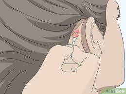 If you have an immediate, mild reaction to the dye, rinse it off immediately and thoroughly with. 3 Easy Ways To Treat An Itchy Scalp After Using Hair Dye Wikihow