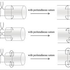 The suture needles, materials, and techniques selected are at the discretion of the surgeon or medical professional assessing the wound. Pdf A Biomechanical Analysis Of The Interlock Suture And A Modified Kessler Loop Lock Flexor Tendon Suture