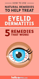 Here are examples of signs and symptoms of common types of dermatitis: 5 Natural Remedies To Treat Eyelid Dermatitis Helloderma Com Eyelid Dermatitis Dermatitis Dermatitis Remedies