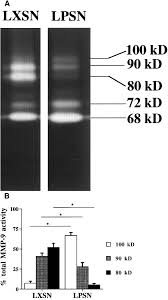 Prevention of Aneurysm Development and Rupture by Local Overexpression of  Plasminogen Activator Inhibitor-1