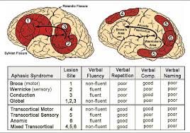 Image result for Neurologic Lesion Localization