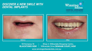 Pin On Clear Choice Dental Implants Cost