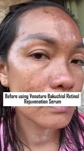 Venature Bakuchiol Retinol Made in Japan
