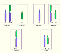 This group is for those (or spouse) with a robertsonian balanced translocation to discuss fertility. Origin Of The Deviating Chromosome Structure