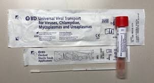 Image result for Herpes Simplex Virus Testing