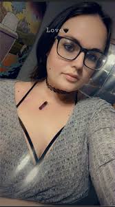 Ban has battle scars from terminal cancer sarcoma, but like sherpa she is a  little fighter she has just turned 10yrs a white siberian huskies, still my  beautiful girl