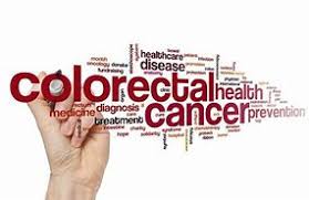 Pharmlinked Colorectal Cancer National Cancer Registry 2007 11