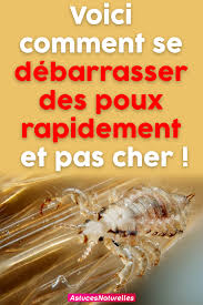 Pin On Astuces Soins
