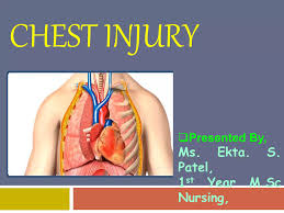 Image result for Chest Trauma