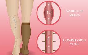 3 Ways Compression Socks And Stockings Help Nurses Mother Nurse Love