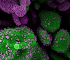 In addition, providers can administer the drug using a subcutaneous injection instead of intravenous infusion when needed. Regeneron Says Antibody Injection Drastically Reduced Covid Infection