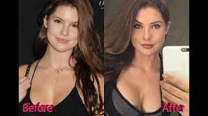 Amanda Cerny Plastic Surgery Before and After Photos 