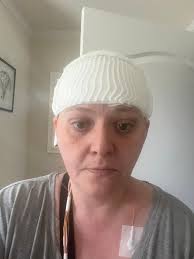 Waiting for results from a 72 hour eeg test