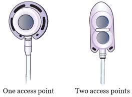 For many financial documents, just 3 years — for others, practically forever. About Your Implanted Port Memorial Sloan Kettering Cancer Center