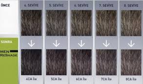 Goldwell Men Reshade 7 Ca Beyazlar Icin Amonyaksiz Kopuk Fiyati