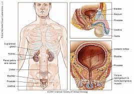Benign prostate enlargement is a condition associated with ageing and is common in men over 50 years of age. Prostate Cancer Medical Illustrations Cancer Net