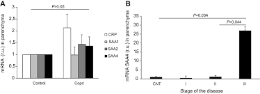 Pulmonary parenchymal damage is a frequent consequence of major trauma to the chest. Evaluation Of Lung Parenchyma Blood Vessels And Peripheral Blood Lym Copd