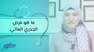 معلومات عن الجدري المائي سطور