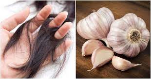 Berapa banyak rambut harus gugur setiap hari? Rambut Gugur Terlalu Banyak Guna Syampu Bawang Putih Untuk Atasinya