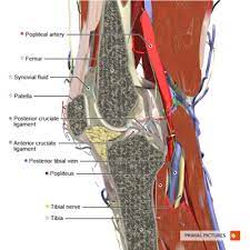 Patellofemoral Pain Syndrome Physiopedia