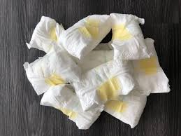 Ich hoffe auf euren rat. Ausscheidungen Hallohebamme