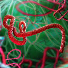 Congo's ebola outbreak might be declared global emergency. Commentary Ebola Virus Transmission Via Contact And Aerosol A New Paradigm Cidrap