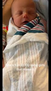 #turnersyndrome #turnersyndromeawareness