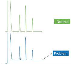 Maybe you would like to learn more about one of these? Gc Troubleshooting In Simple Pictures Part I