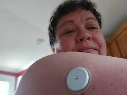 Best glucose monitoring system kit for iPhone