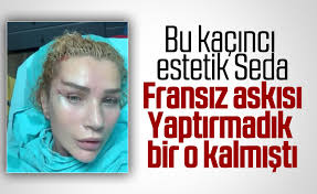 Magazin #sedasayan #estetik seda sayan, 'fransız askısı' adlı yöntemle bir kez daha yüzünü beyaz tv seda sayanın programında estetik plastik cerrah sayın profesör doktor nazım durak. Seda Sayan Yuzune Estetik Yaptirdi