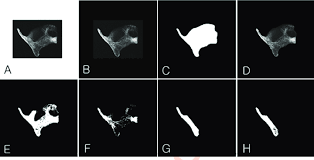 Basically, all we need to do is just inverse the image and also play around with some layer blending options. Footsteps For Image Processing Of X Ray Photographs Using Adobe Download Scientific Diagram
