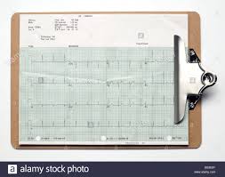 Chart On Clipboard Clip Board Elevated View Stock Photo