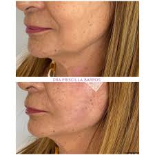 Dra Priscilla Barross