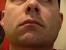 Laser Hair Removal Men Face