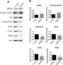 24 hour pest control, londra. P66shc Activation Promotes Increased Oxidative Phosphorylation And Renders Cns Cells More Vulnerable To Amyloid Beta Toxicity Scientific Reports