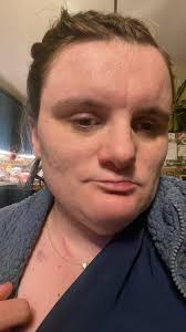 Surviving a car accident with a complex medical history