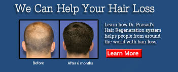 Best cbd oils for hair loss in 2020 when buying cbd oil, you shouldn't act on the spur of the moment. Hair Restoration Hair Regrowth New York