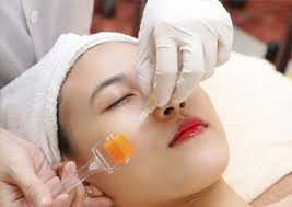 Công nghệ lăn kim