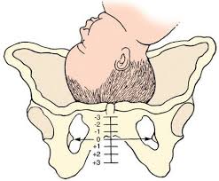 pin on progress in labor