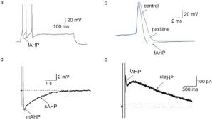 Different styles of intermittent fasting may suit different people. Action Potentials Are Followed By Fast And Slow Afterhyperpolarizations Download Scientific Diagram