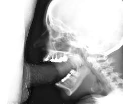 Рентген минета