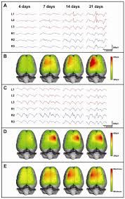 (a + b)2 = a2 + 2ab + b2. Lateral Expansion Of Spike Field Potentials A Sample Eeg Traces And Download Scientific Diagram