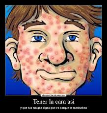 Imagenes Y Carteles De Acne Pag 6 Desmotivaciones