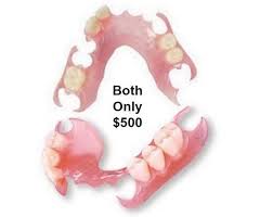 Affordable Denture Back Teeth Acrylic Back Upper Or Lower Back Etsy In 2020 Dentures Affordable Dentures Partial Dentures