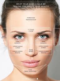 Pimples And Organs Face Mapping Acne Face Mapping Face Acne
